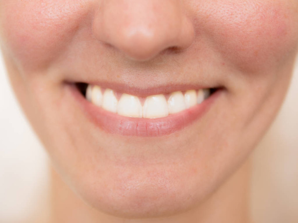 Όμορφο χαμόγελο νεαρή γυναίκα. Λευκά δόντια, σύμφωνα με το γενικό σχέδιο. - Φωτογραφία, εικόνα