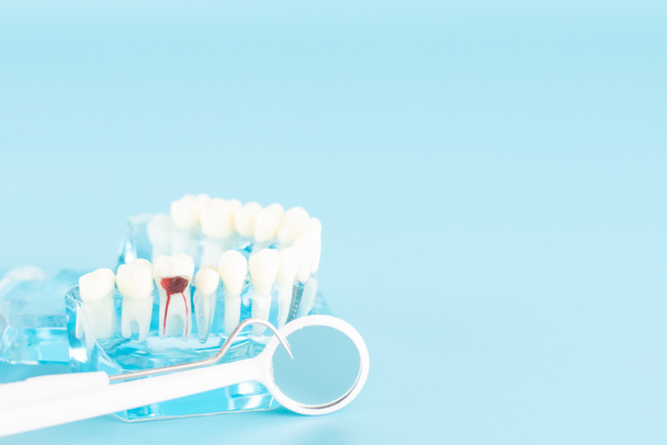 Vérification dentaire avec modèle dentaire dans le concept de soins buccodentaires
. - Photo, image