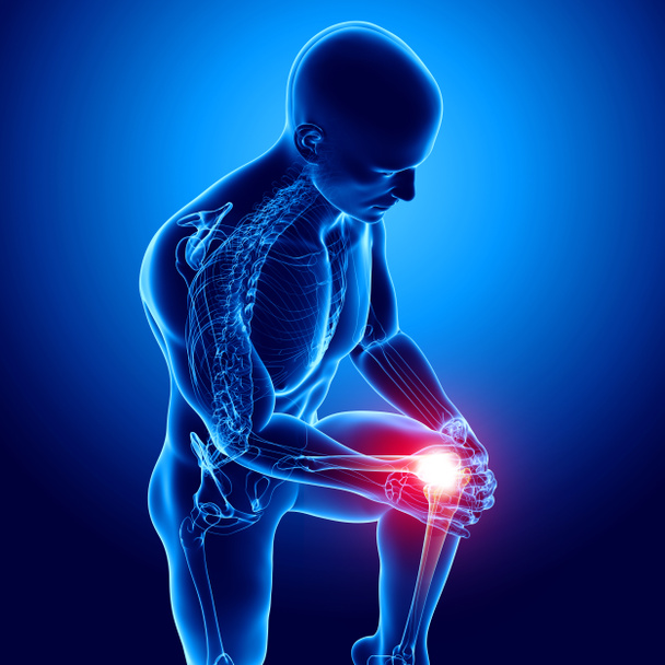 douleur au genou masculin
 - Photo, image