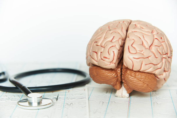 Μοντέλο του ανθρώπινου εγκεφάλου και ένα μαύρο στηθοσκόπιο σε φόντο των εγκεφαλικών κυμάτων από το ηλεκτροεγκεφαλογράφημα - Φωτογραφία, εικόνα
