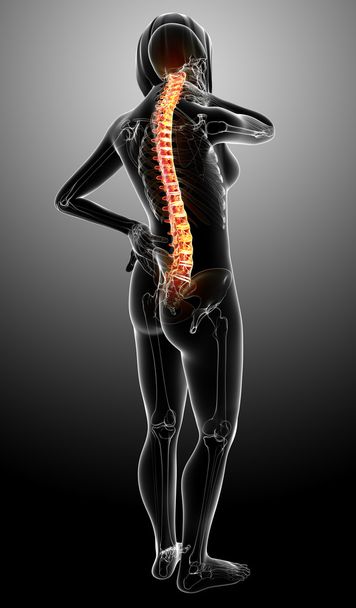 Female spine pain x-ray anatomy - Photo, Image