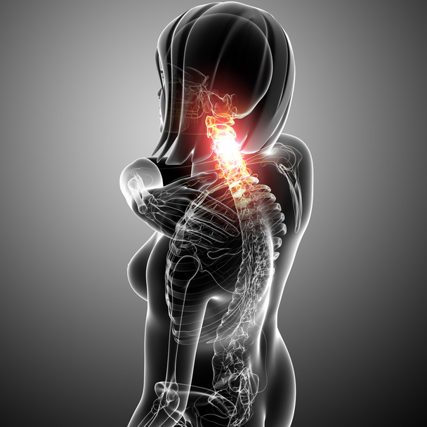 x-ray of neck pain female - Photo, Image