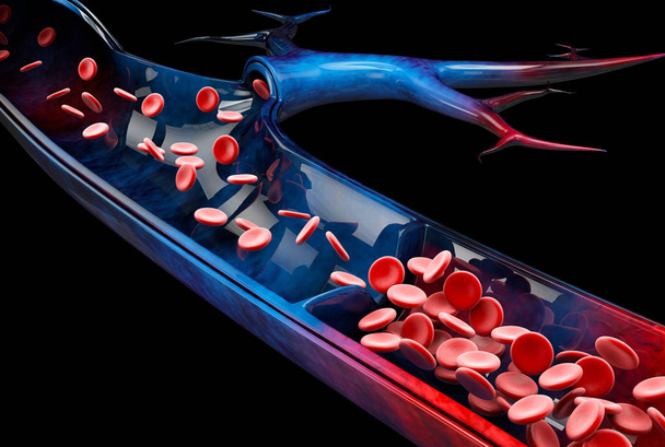 静脈瘤をクローズ アップ。黒の背景、3 d イラストレーションに人間の足. - 写真・画像