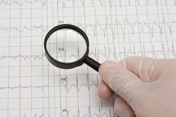 Electrocardiogram on paper. Hand in medical glove holding a magnifying glass. Close up - Foto, Imagen