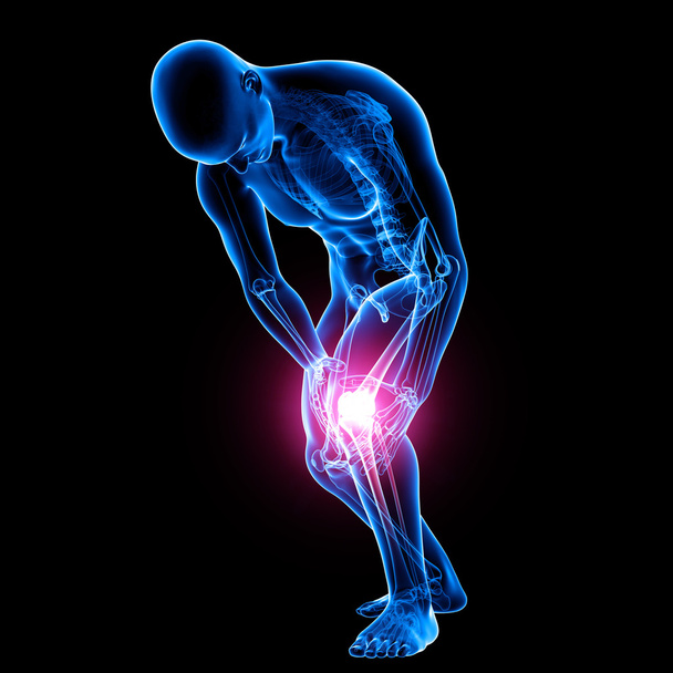 dolore al ginocchio maschile
 - Foto, immagini