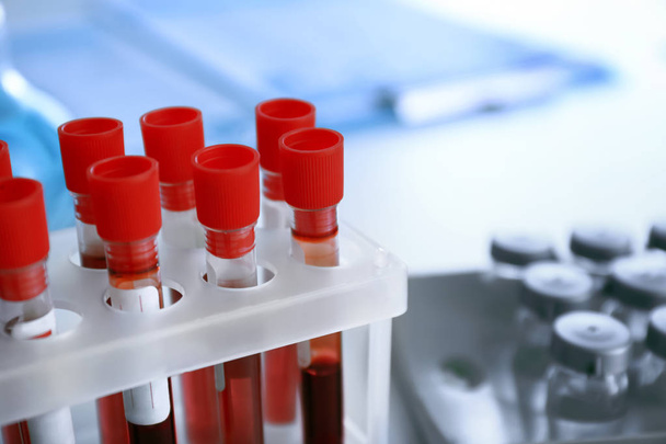 Test tubes with blood samples on table in laboratory, closeup - Foto, afbeelding