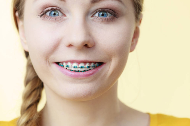 Dentist and orthodontist concept. Young woman teen girl smiling showing teeth with blue braces - Фото, зображення