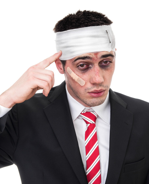 Man with bruised eyes and head - Foto, afbeelding