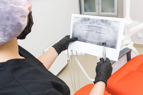 Zubní klinika. Příjem, vyšetření pacienta. Péče o zuby. Zubař vypadá RTG snímek pacientů čelisti - Fotografie, Obrázek
