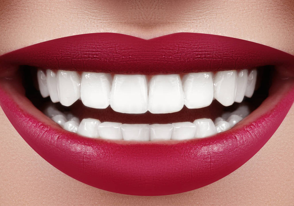 Gyönyörű mosoly fehérítő fogakkal. Fogászati fotó. Macro Closeup Tökéletes Női Száj, Lipjesztő Rutin. Törődjön a fogak, Ortodontic kezelés - Fotó, kép