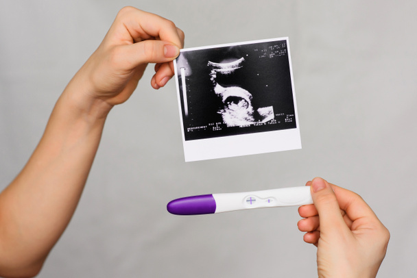 Ultraschallbild und positiver Schwangerschaftstest in den Händen eines Mädchens - Foto, Bild