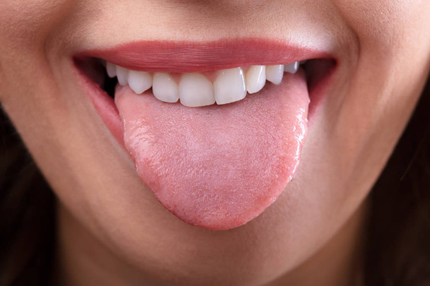 Close-up Of A Woman's Face Showing Her Clean Tongue - 写真・画像