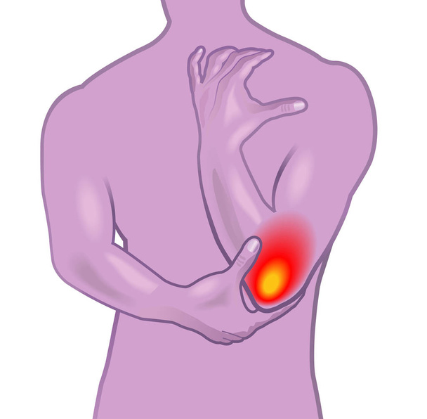 肘の痛みのベクトル図  - ベクター画像