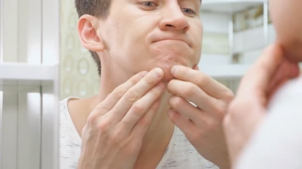close up of young man standing close to a mirror in the bathroom and squeezing a pimple on his face - Footage, Video