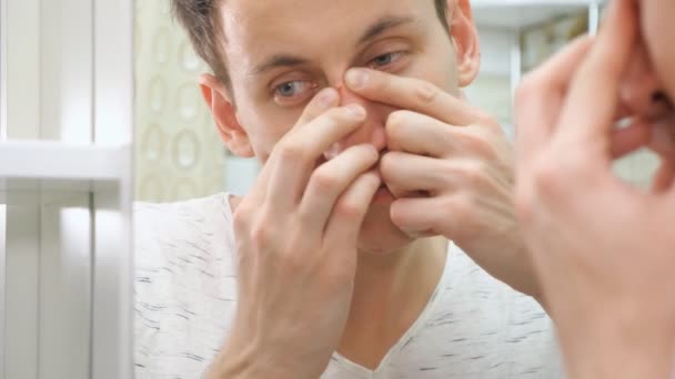 close up of young man standing close to a mirror in the bathroom and squeezing a pimple on his face - Footage, Video