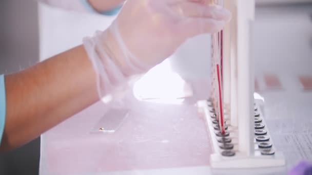 Medical clinic. A blood test. A nurse working with blood samples. Side angle - Footage, Video