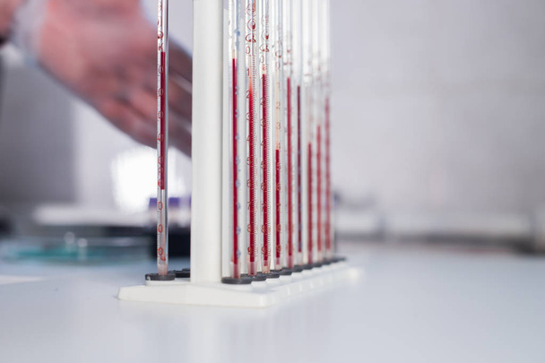 Medical clinic. A stand with pipettes filled with different blood. - Photo, Image