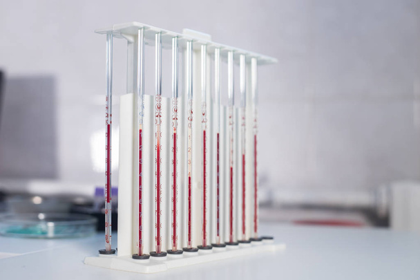 A stand with pipettes filled with blood - Photo, Image