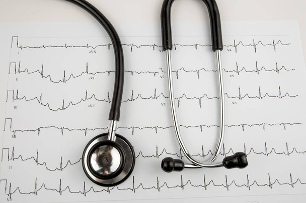 Az EKG (EKG) grafikonon (felülnézetben sztetoszkóp) - Fotó, kép