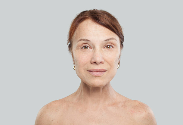 Volwassen vrouwelijke gezicht op witte achtergrond. Geconfronteerd met tillen, visagie, esthetische geneeskunde en plastische chirurgie concept - Foto, afbeelding