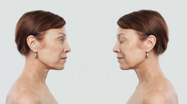 Портрет зрелой женщины. Концепция лечения лица, косметологии, эстетической медицины и пластической хирургии
 - Фото, изображение