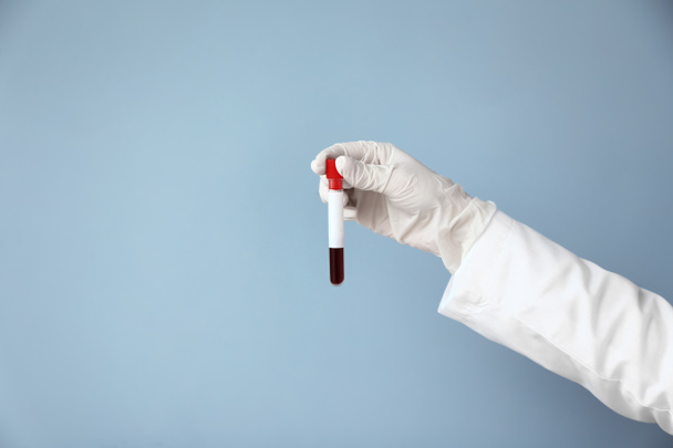 Hand of laboratory assistant holding test tube with blood sample on color background - Photo, Image