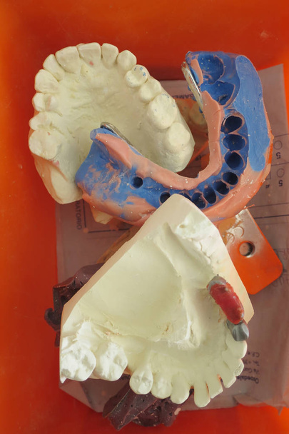 fogászati laboratórium építési fogászati benyomásait - Fotó, kép