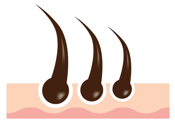 Materiale dell'immagine vettoriale del follicolo pilifero / concetto di cura dei capelli e stile di vita sano
. - Vettoriali, immagini