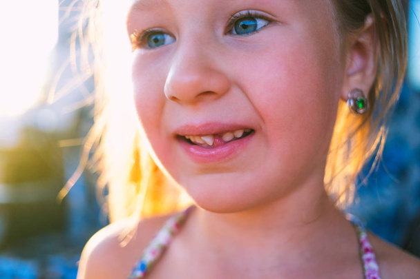 Portrait of a little girl with an outstretched milk tooth. - Photo, Image