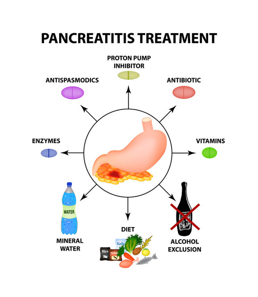 Pankreatitis-Behandlung. die Struktur des Magens und der Bauchspeicheldrüse. Infografiken. Vektor-Illustration auf isoliertem Hintergrund - Vektor, Bild