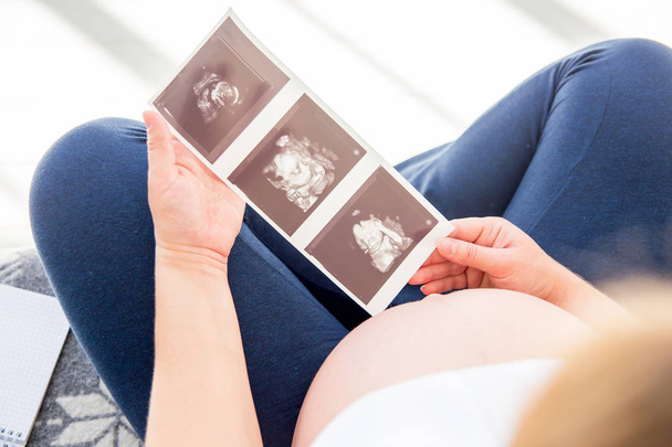 Pregnant woman holding ultrasound image of her future baby - Photo, image