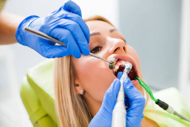 Uma jovem no dentista. A dentista está a polir os dentes.. - Foto, Imagem