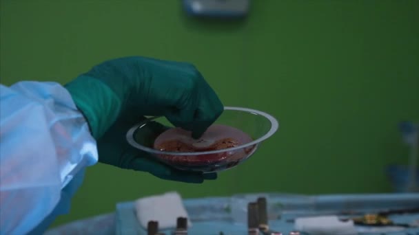 Cirujano preparando implante de silicona mamaria para la operación
 - Imágenes, Vídeo