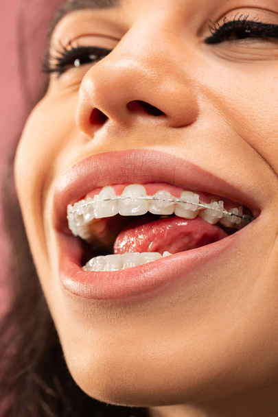 Красивая молодая женщина с зубными скобками
 - Фото, изображение