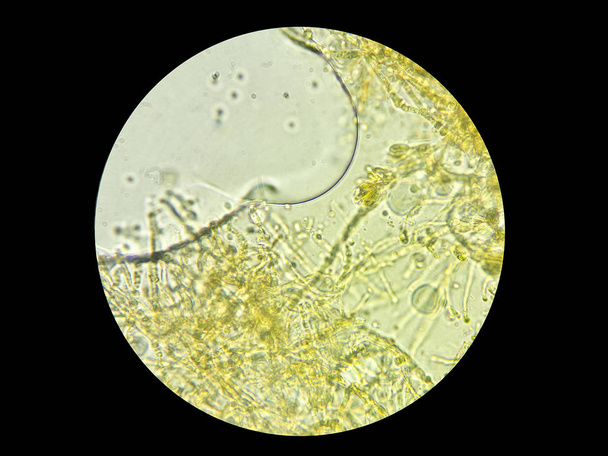 Imagen de hongos microscópicos obtenidos a través de un microscopio de luz
 - Foto, Imagen