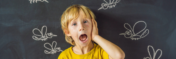 Little boy with funny facial expression and bites on face in front of blackboard with chalk drawn mosquitoes.  - Foto, Imagem