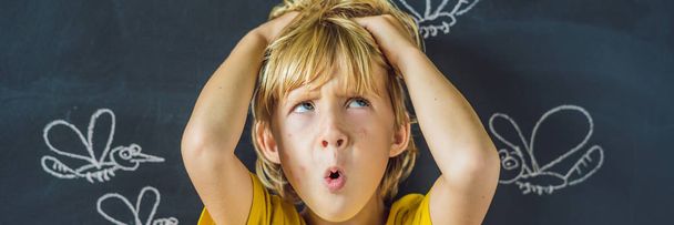 Little boy with funny facial expression and bites on face in front of blackboard with chalk drawn mosquitoes.  - Photo, Image