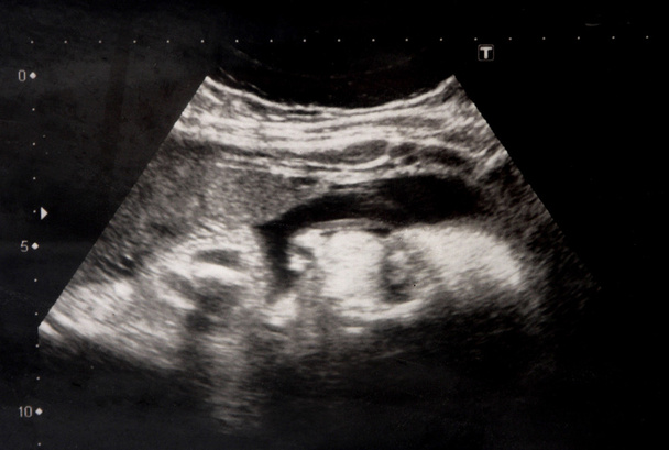 Baby-Ultraschall - Foto, Bild
