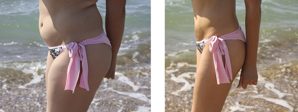 Dziewczyna w stroju kąpielowym na morze odchudzanie przed i po diecie - Zdjęcie, obraz