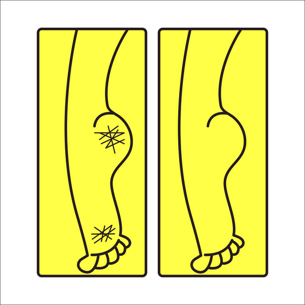 care for dry calloused feet - Vector, Image