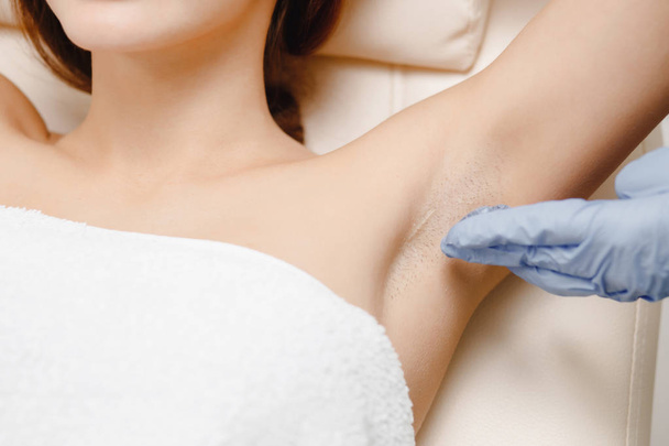 Close-up armpit. Laser hair removal underarms. Specialist applies gel - Foto, Imagen