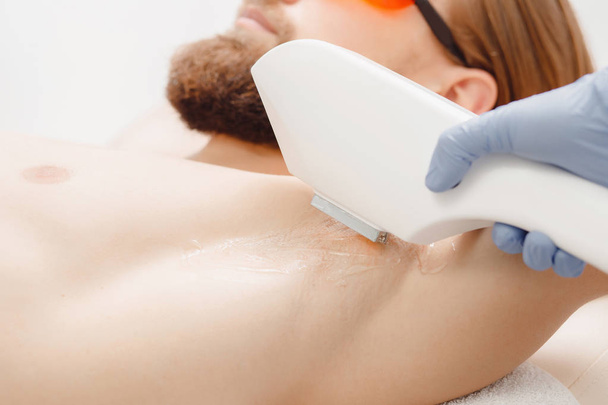 Laser hair removal of armpits man with special device. Close up - Photo, Image