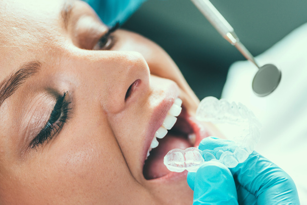  Jovem mulher com dentes dentários Whitening Procedimento
 - Foto, Imagem