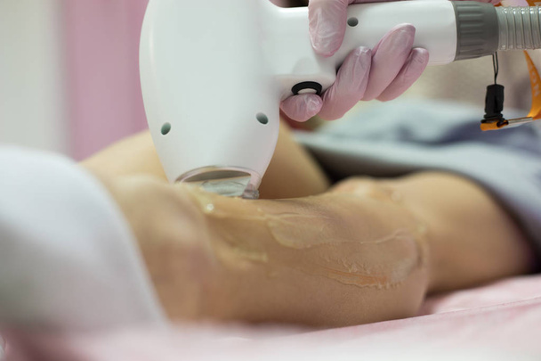 Laser epilation and cosmetology. Laser hair removal cosmetology procedure. - Zdjęcie, obraz