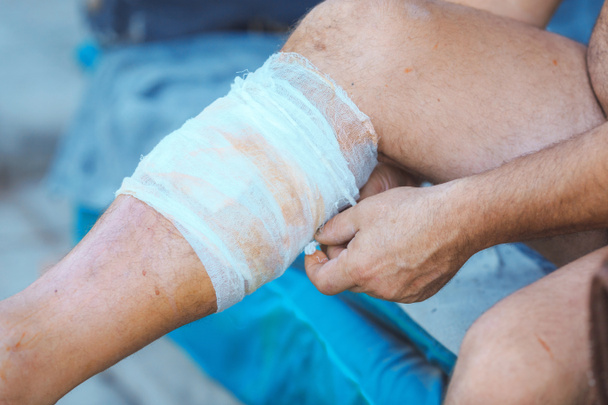 proces stosowania bandaż na rannych nogę - Zdjęcie, obraz