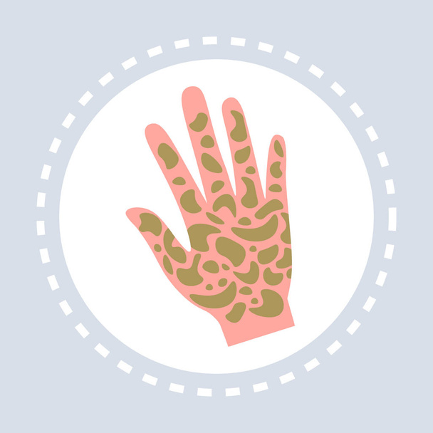 Psoriasis Schienbeinerkrankung menschliche Handfläche Symbol Gesundheitswesen Medizinischer Dienst Logo Medizin und Gesundheitssymbol Konzept flach - Vektor, Bild