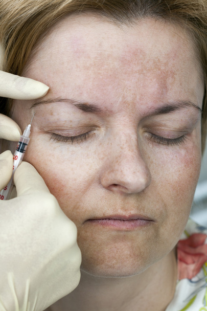 Botox injekció - Fotó, kép