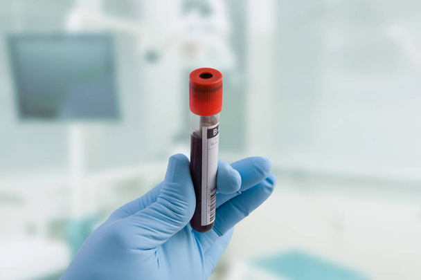 Arzthand mit medizinischem Handschuh hält Blutsonde und Labor im Hintergrund - Foto, Bild
