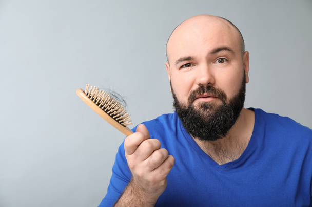 Man with hair loss problem on light background - Photo, Image