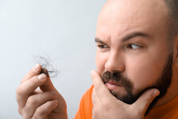 Homem com problema de perda de cabelo no fundo claro
 - Foto, Imagem